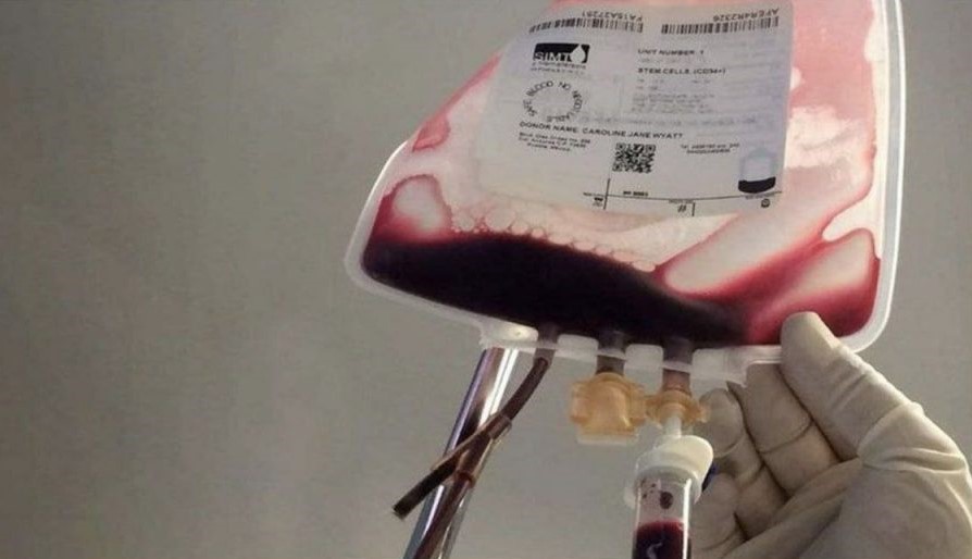 Read more about the article Univerzalni protuotrov pomaže cijepljenim osobama da očiste vlastitu zatrovanu krv