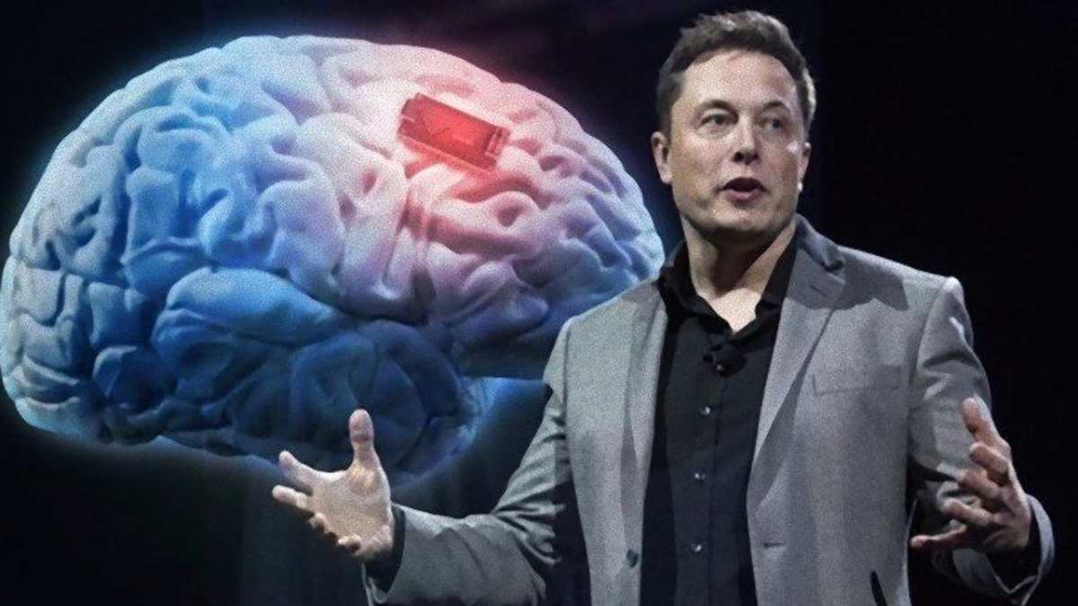 Read more about the article <strong>Tvrtka za moždane čipove Elona Muska Neuralink korak je bliže ispitivanjima na ljudima</strong>